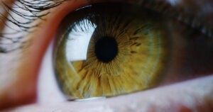 An Ocular Melanoma By JC Williams