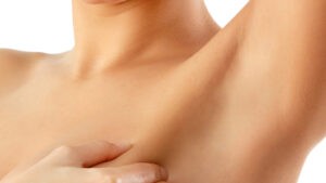 That Time I Had Cancer By Allison McCarthy